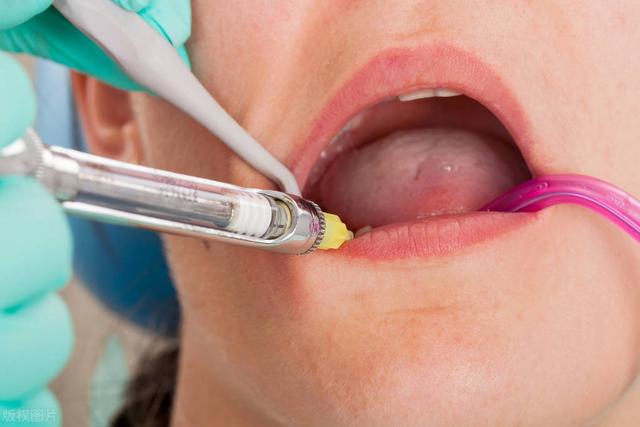 进行种植牙手术时，需要打麻药吗？专家给出真实答案