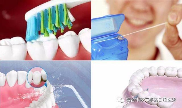 种植牙该怎么维护？专业口腔医院带你了解种植牙的方方面面