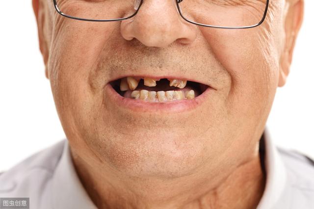 牙齿缺失危害大，想种牙为何医生却让我先植骨？听听看牙医怎么说