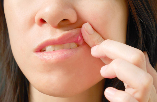 牙龈角化粘膜对种植体周围的软硬组织有什么影响吗？