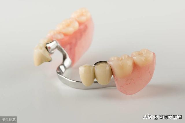 口腔科常见知情同意书或注意事项之总义齿修复治疗同意书