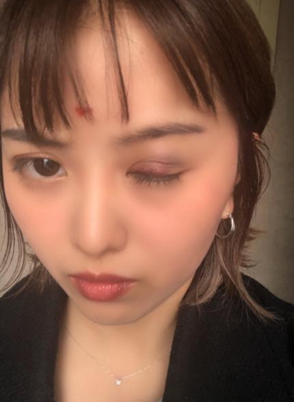 日本美女格斗选手被中年醉汉暴行未还击而造成重伤!