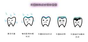 一天中最该刷牙的时刻，偷懒的人危险了！现在知道还不晚